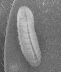 Close-up image of small, white, spherical eggs on a leaf, resembling butterfly or insect eggs.