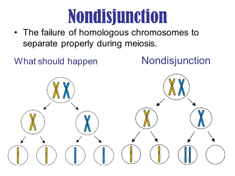 Diagram showing normal chromosome separation compared to nondisjunction during meiosis