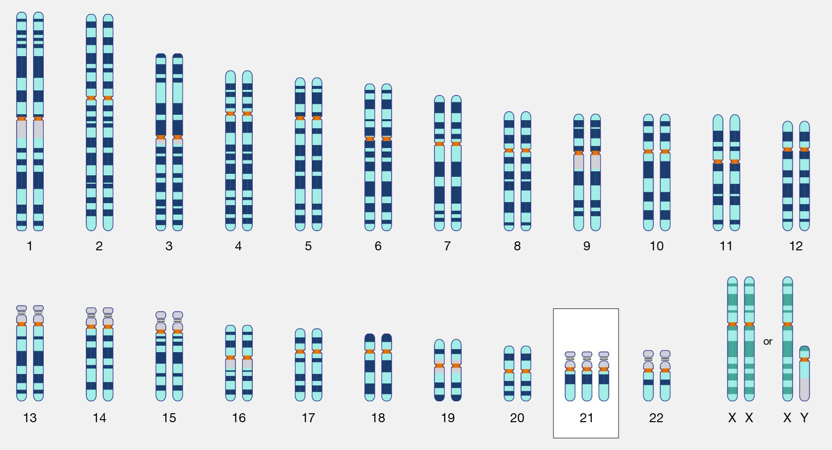 null Karyotype diagram showing chromosomes with trisomy 21 indicating Down syndrome