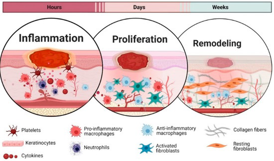 Diagram showing stages of wound healing: inflammation, proliferation, and remodeling.