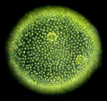 Microscopic mold representing Fungi